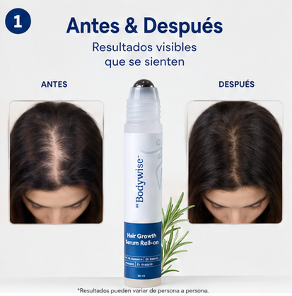 Body Wise™ Hair Growth Serum | Fortalece y Estimula el Crecimiento Capilar