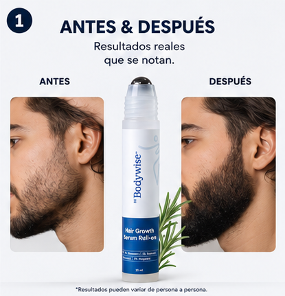 Body Wise™ Hair Growth Serum | Fortalece y Estimula el Crecimiento Capilar